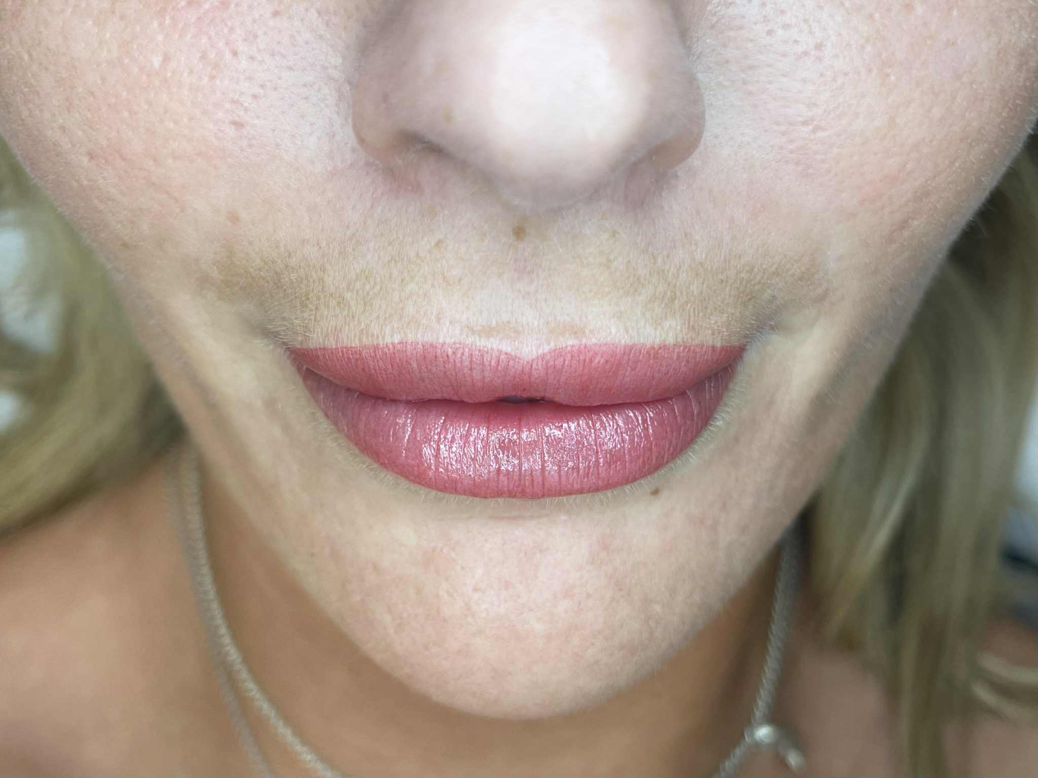 Professional Lip Treatment Result